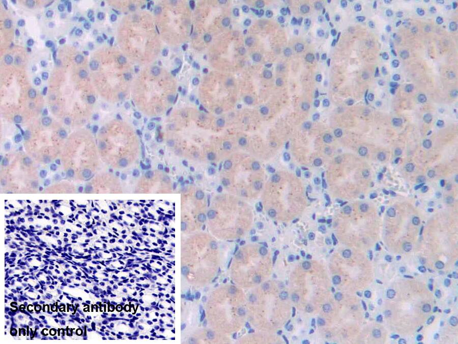 UCH-L4 Antibody