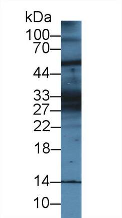 KRT28 Antibody