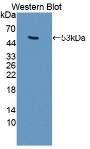 KRT25 Antibody