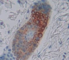 KRT25 Antibody