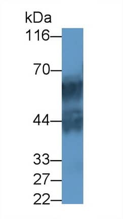 Cytokeratin 71 Antibody