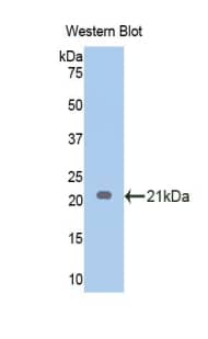 Endothelin-1 Antibody (5#)