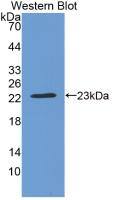 CRYBB2 Antibody (6#)