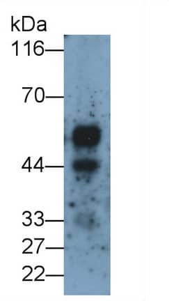 KiSS1R/GPR54 Antibody (D12)