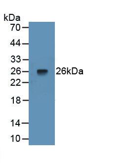 Pentraxin 3/TSG-14 Antibody (C3)