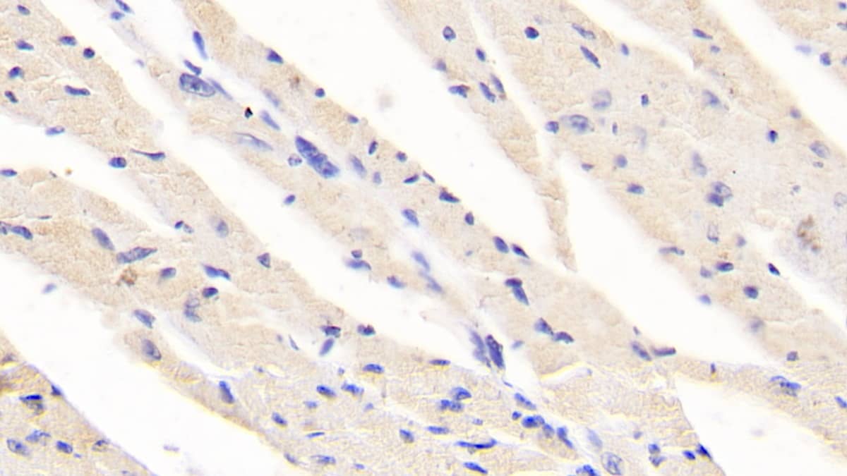 Ret Antibody (C1)
