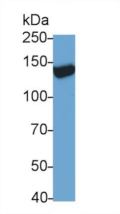 TRPM4 Antibody (C1)