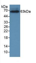 CRHBP Antibody (C11)