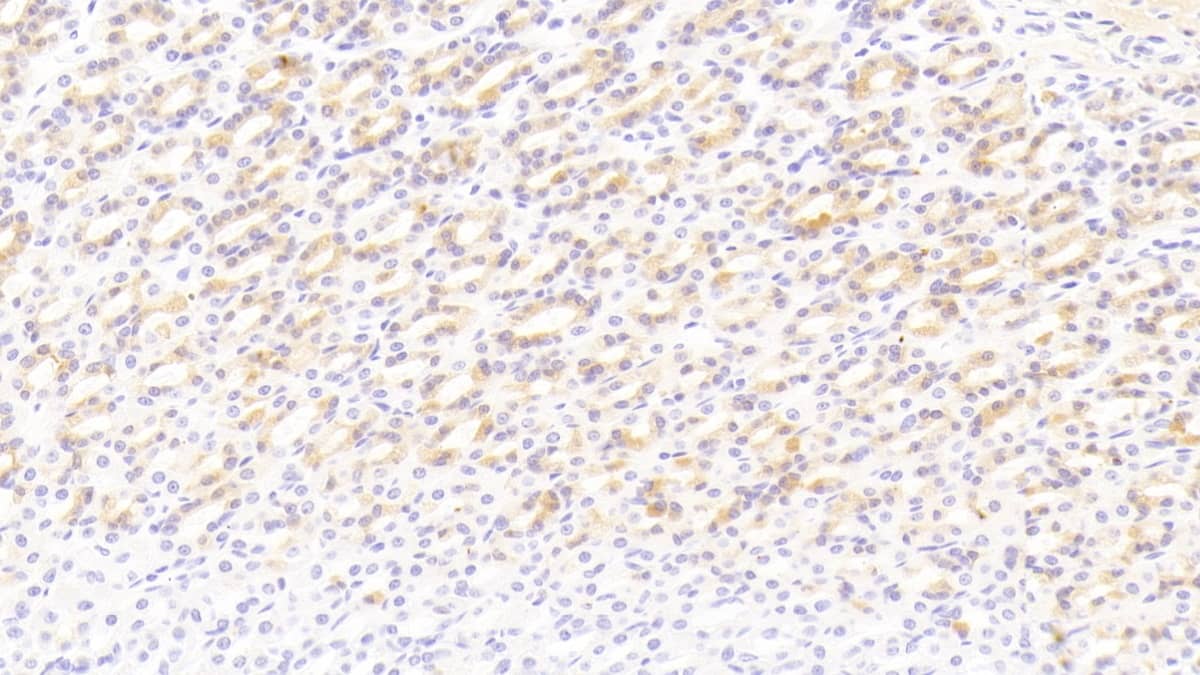 BMP-3 Antibody (C6)