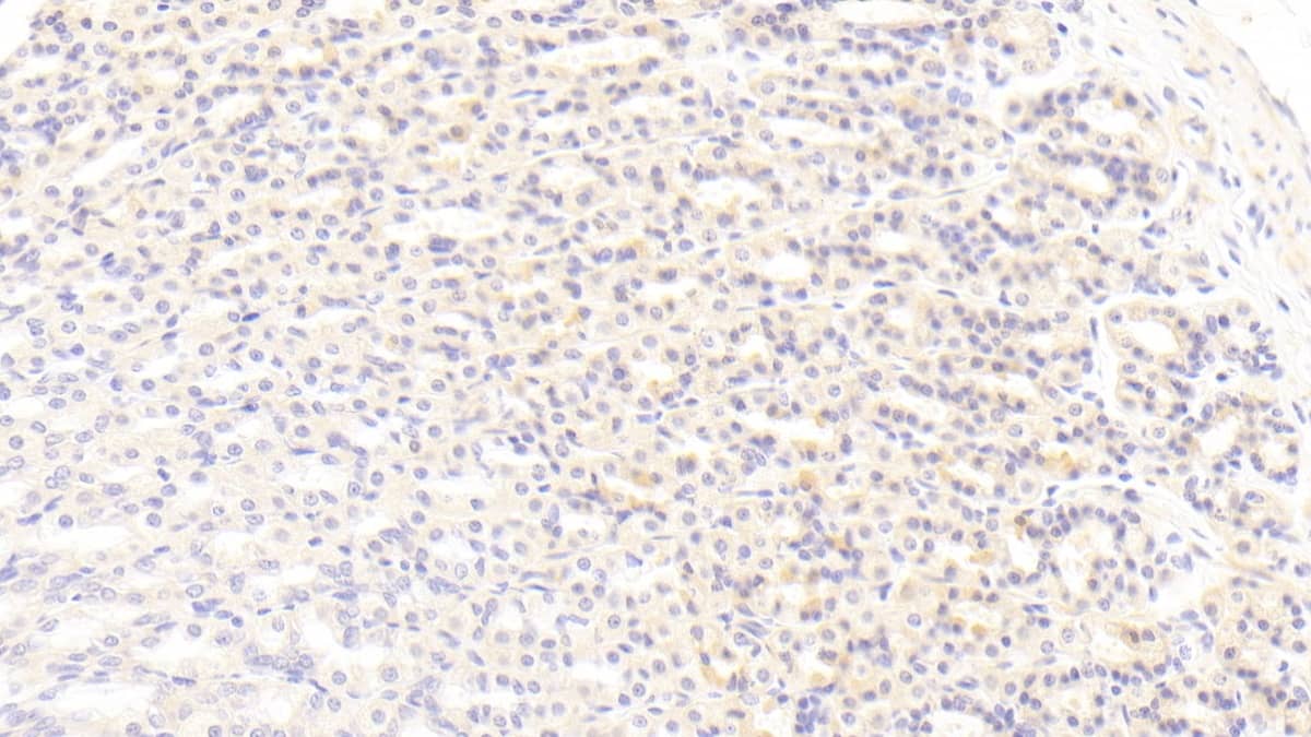 BMP-3 Antibody (C9)