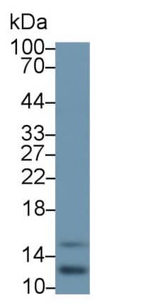 RBX1 Antibody (C1)