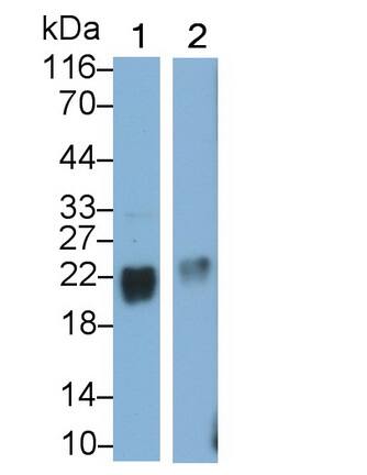 Stathmin-2/STMN2 Antibody