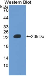 Hemoglobin epsilon Antibody (D4)