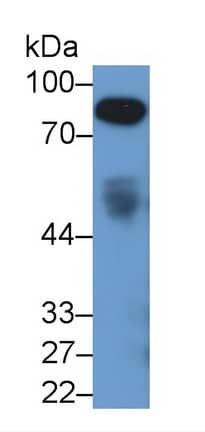 Afamin Antibody (C1)