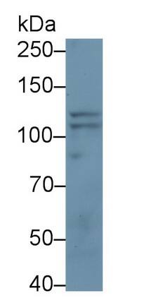 Neuropilin-2 Antibody (D15)