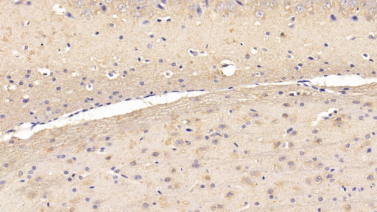 HspBP1 Antibody (C3)