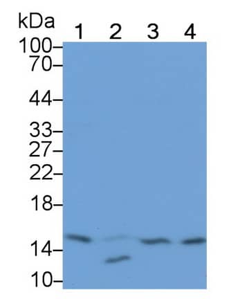 RBX1 Antibody (C5)