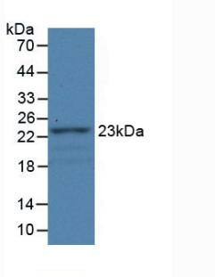 Fibulin 1 Antibody (C2)