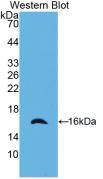 RAIDD/CRADD Antibody (23#)