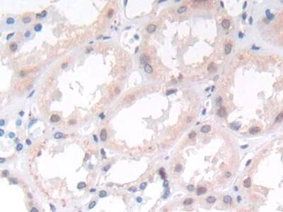 Matriptase/ST14 Antibody (C4)