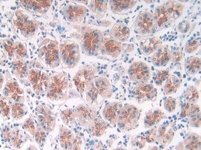 Matriptase/ST14 Antibody (C4)