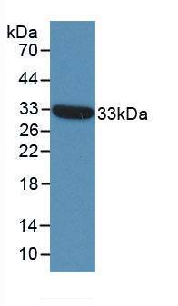 Matriptase/ST14 Antibody (C4)