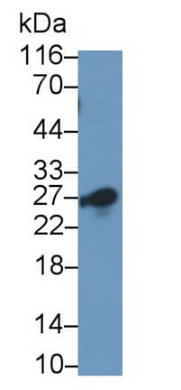 CD8 beta Antibody (C1)