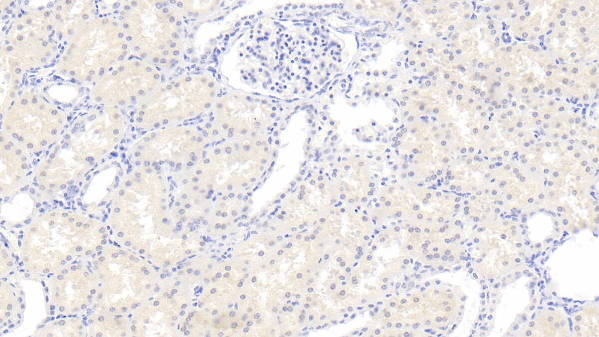 RHD Antibody (C2)