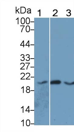 Angiopoietin-like protein 8/Betatrophin Antibody (D3)