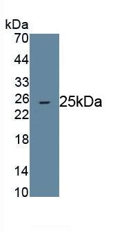 Angiopoietin-like protein 8/Betatrophin Antibody (D3)