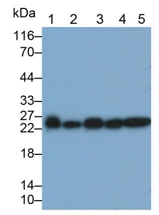 Gankyrin Antibody (C2)