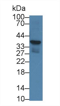 CRHBP Antibody (D2)