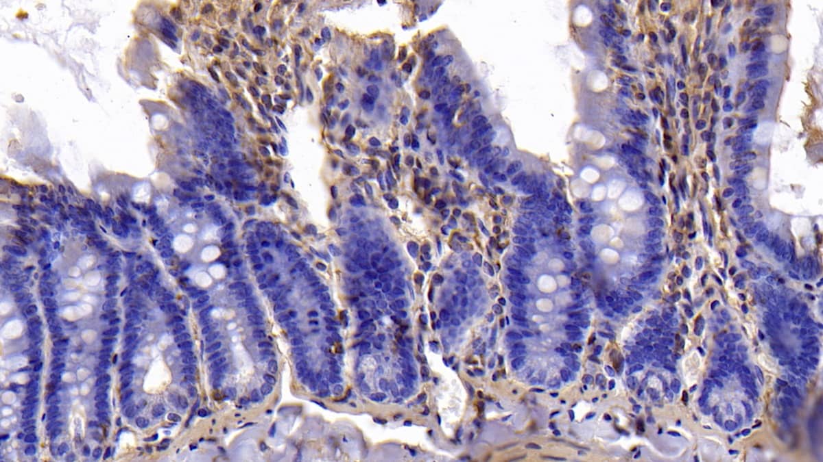 Bcl-xL Antibody (C2)