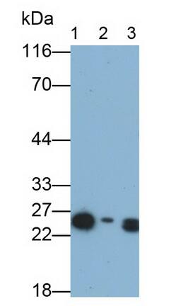 EPDR1 Antibody (C4)