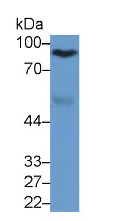 Afamin Antibody (C10)