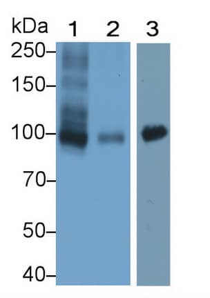 WFS1 Antibody (C3)