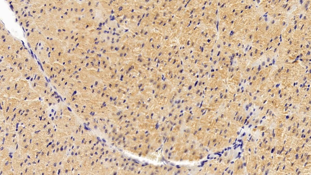 WFS1 Antibody (C7)