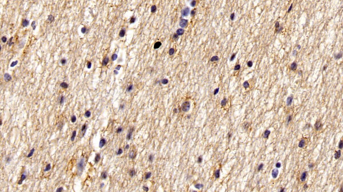 WFS1 Antibody (C15)