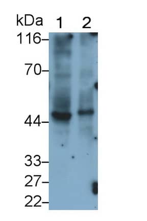 Peptidase Inhibitor 16/PI16 Antibody (C13)