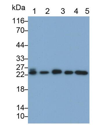 Gankyrin Antibody (C5)