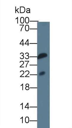 IL-36 gamma/IL-1F9 Antibody (D2)