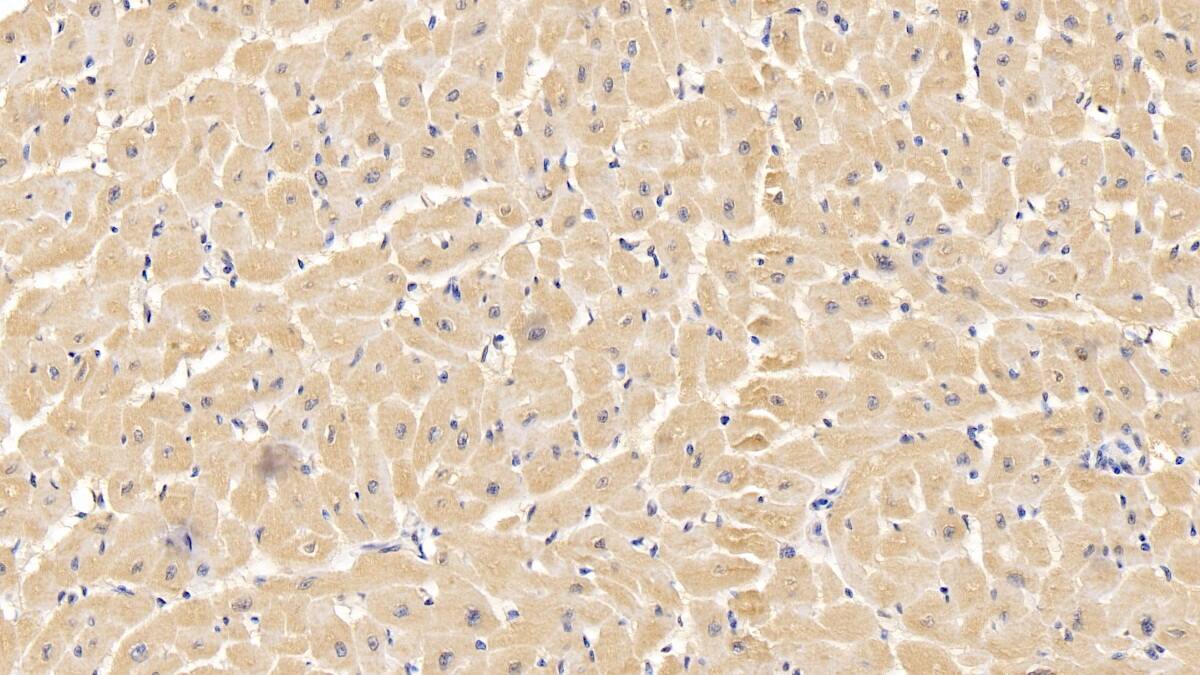 VDAC1 Antibody (C1)