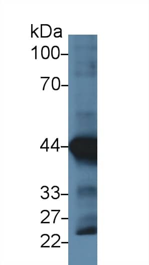 Actin Alpha 1 Cardiac Muscle Antibody (C3)