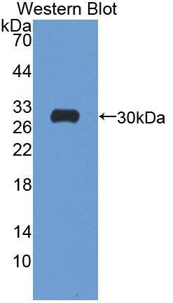 ATP1B4 Antibody