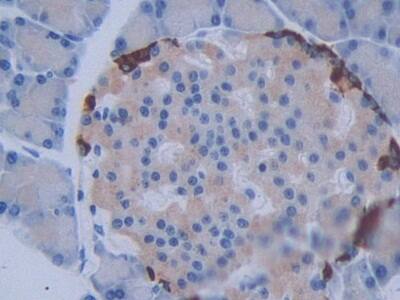 METTL21C Antibody