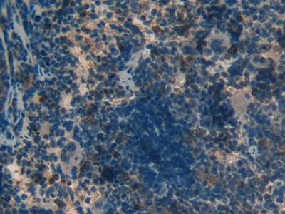 MT-ND5 Antibody