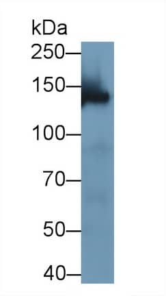 WWC3 Antibody