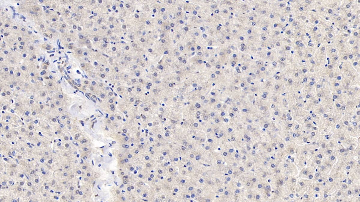 Angiopoietin-like protein 8/Betatrophin Antibody (C6)