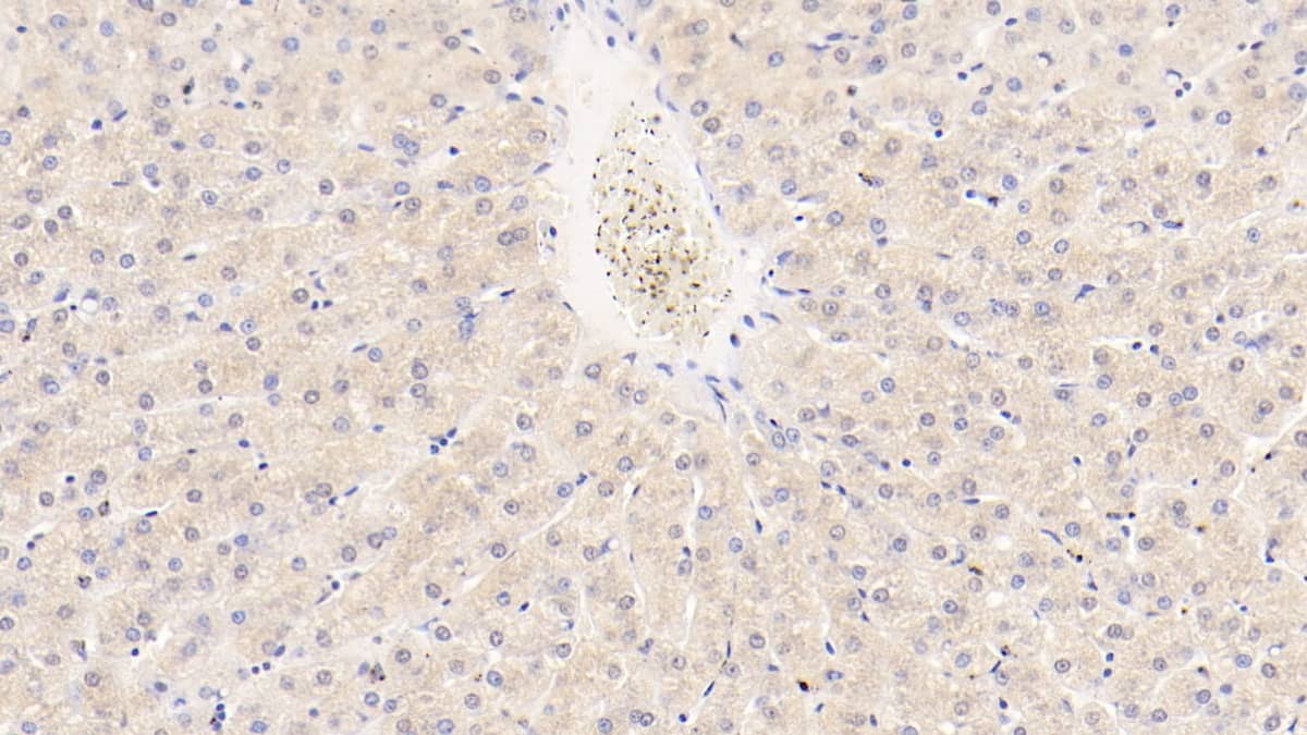 Angiopoietin-like protein 8/Betatrophin Antibody (C5)