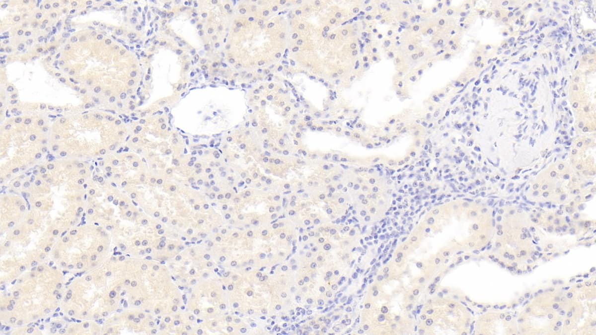 RHD Antibody (C1)